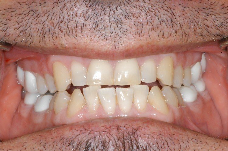 Frangella Dental Top Rated Dentist Midtown Manhattan