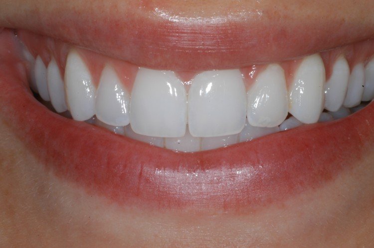 Frangella Dental White Smile